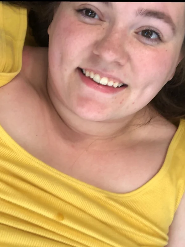 Dimples