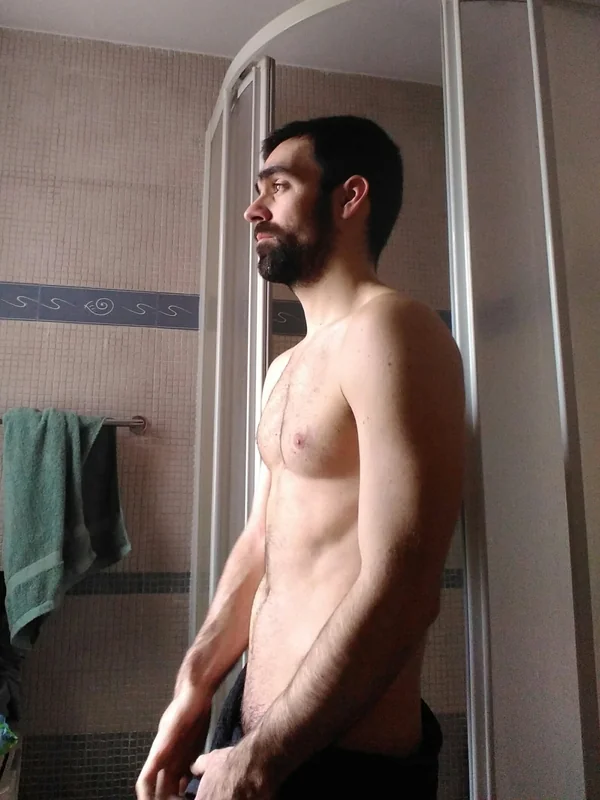 Frikitus (FREE)