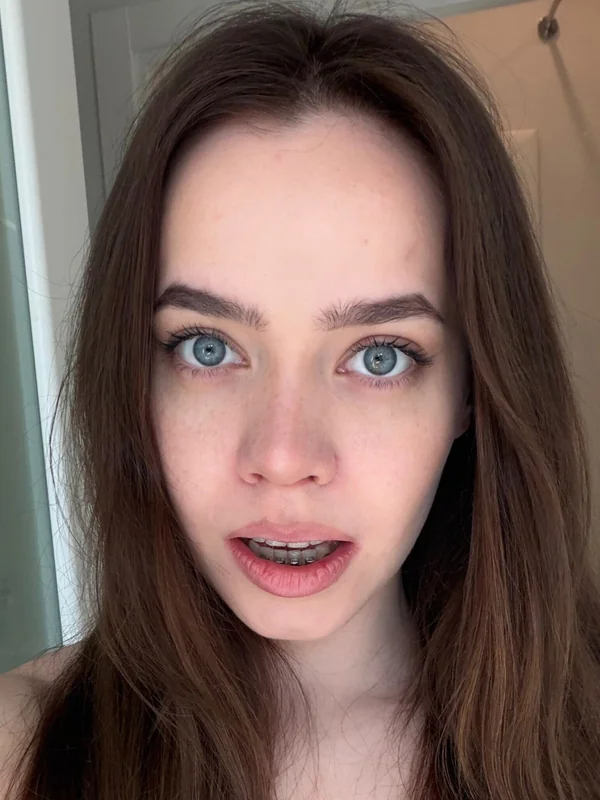 Medusa 🍯